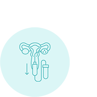 Follicular aspiration