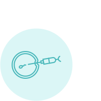 Sperm microinjection (ICSI)